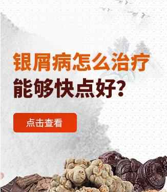 銀屑病怎么治療能夠快點(diǎn)好？